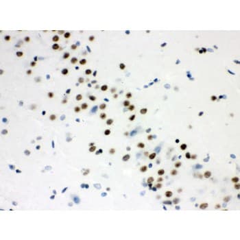 Polyclonal Rabbit anti-Human WNT2B Antibody (aa87-112, IHC, WB)