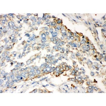 Polyclonal Rabbit anti-Human WNT2B Antibody (aa87-112, IHC, WB)