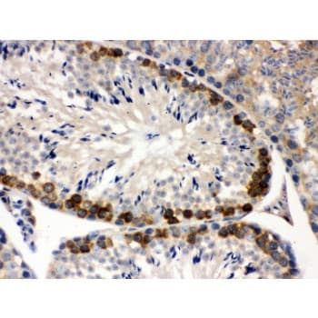 Polyclonal Rabbit anti-Human YBX1 / YB1 Antibody (aa293-320, IHC, WB)