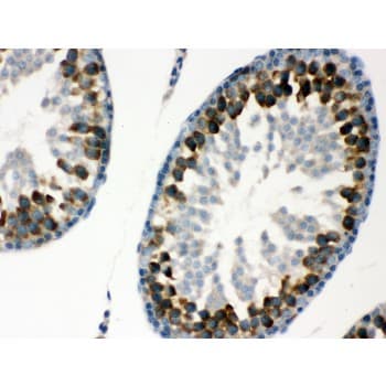 Polyclonal Rabbit anti-Human YBX1 / YB1 Antibody (aa293-320, IHC, WB)