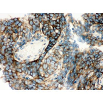 Polyclonal Rabbit anti-Human YBX1 / YB1 Antibody (aa293-320, IHC, WB)