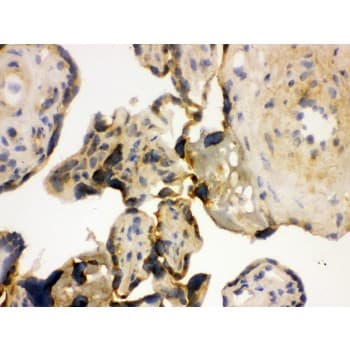 Polyclonal Rabbit anti-Human YBX1 / YB1 Antibody (aa293-320, IHC, WB)