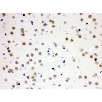 CDC25B Antibody (aa119-248)