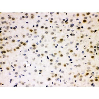 CDC25B Antibody (aa119-248)