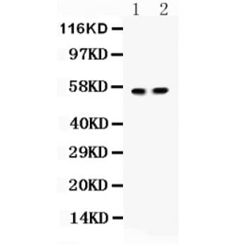 Polyclonal Rabbit anti-Human ICA69 / ICA1 Antibody (aa243-276, WB)