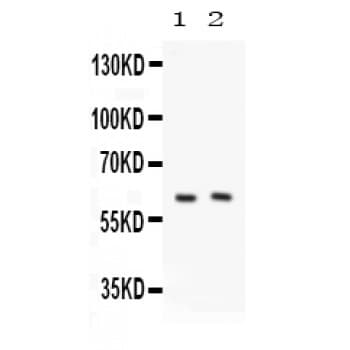 PKLR Antibody (aa522-552)