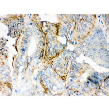 PKLR Antibody (aa522-552)