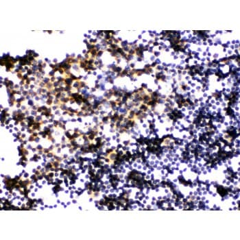 Polyclonal Rabbit anti-Human PLK1 / PLK-1 Antibody (aa86-430, IHC, WB)