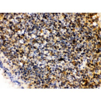 Polyclonal Rabbit anti-Human PLK1 / PLK-1 Antibody (aa86-430, IHC, WB)