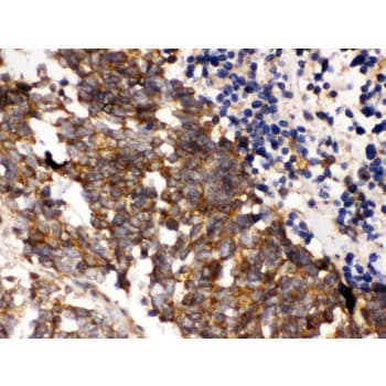 Polyclonal Rabbit anti-Human PLK1 / PLK-1 Antibody (aa86-430, IHC, WB)