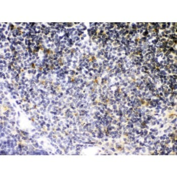 TNFRSF1B / TNFR2 Antibody (aa296-324)