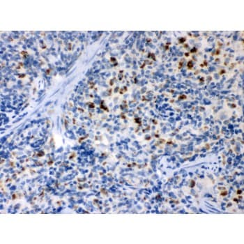 TNFRSF1B / TNFR2 Antibody (aa296-324)