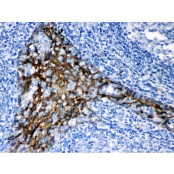 Polyclonal Rabbit anti-Human TRAF2 Antibody (aa308-339, IHC, WB)