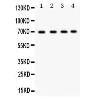 XRCC6 / Ku70 Antibody (aa464-496)