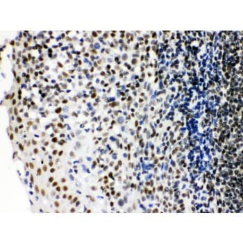 XRCC6 / Ku70 Antibody (aa464-496)