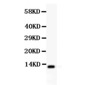 Polyclonal Rabbit anti-Human TFF1 / pS2 Antibody (aa25-84, WB)