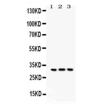 Polyclonal Rabbit anti-Human BCL10 / BCL-10 Antibody (aa1-233, WB)
