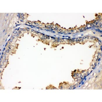 Polyclonal Rabbit anti-Human ALK-6 / BMPR1B Antibody (aa14-184, IHC, WB)