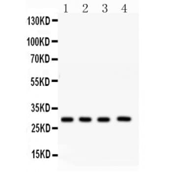 CA1 / Carbonic Anhydrase I Antibody (aa9-261)