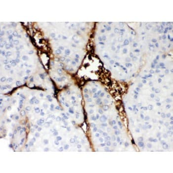 CA1 / Carbonic Anhydrase I Antibody (aa9-261)