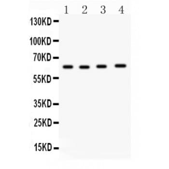 Polyclonal Rabbit anti-Human CDC6 Antibody (aa147-549, IHC, WB)