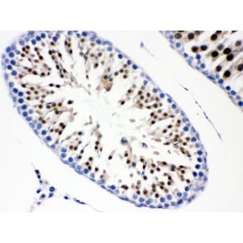 Polyclonal Rabbit anti-Human CDC6 Antibody (aa147-549, IHC, WB)