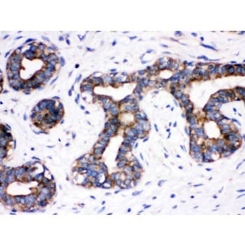 Polyclonal Rabbit anti-Human CDC6 Antibody (aa147-549, IHC, WB)