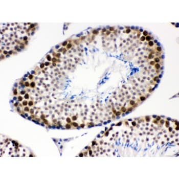 CDK1 / CDC2 Antibody (aa66-297)