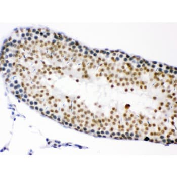 CDK1 / CDC2 Antibody (aa66-297)