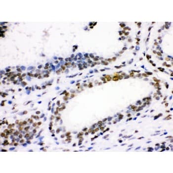 CDK1 / CDC2 Antibody (aa66-297)