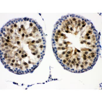 Polyclonal Rabbit anti-Human CDK2 Antibody (aa81-298, IHC, WB)