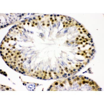 Polyclonal Rabbit anti-Human CDK2 Antibody (aa81-298, IHC, WB)