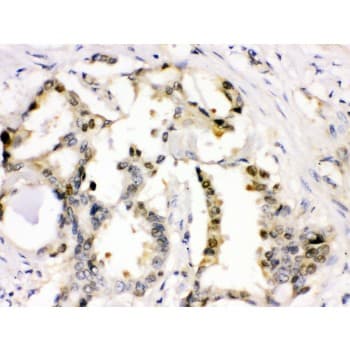 Polyclonal Rabbit anti-Human CDK2 Antibody (aa81-298, IHC, WB)