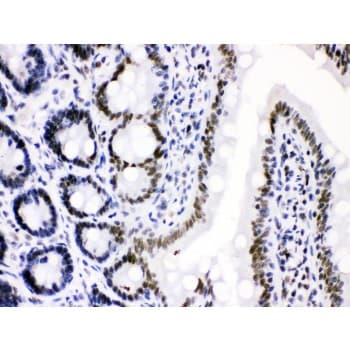 Polyclonal Rabbit anti-Human CDK9 Antibody (aa141-372, IHC, WB)