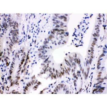 Polyclonal Rabbit anti-Human CDK9 Antibody (aa141-372, IHC, WB)