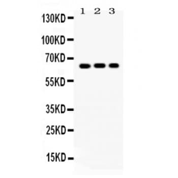 Polyclonal Rabbit anti-Human CRY1 Antibody (aa153-189, WB)