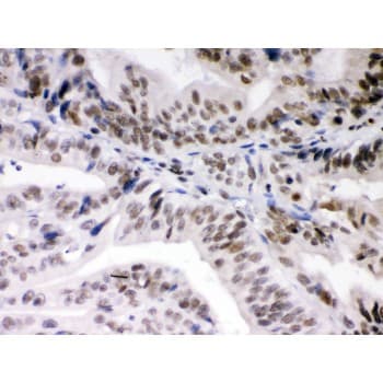 DAXX Antibody (aa56-345)