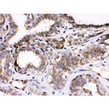 Polyclonal Rabbit anti-Human PARVA Antibody (aa155-185, IHC, WB)
