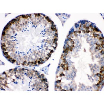 STMN1 / Stathmin / LAG Antibody (aa2-34)