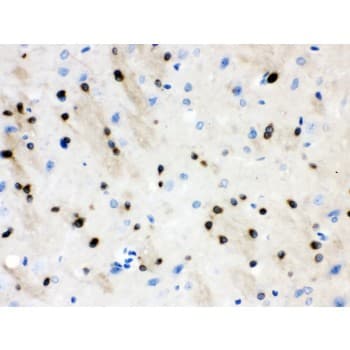 STMN1 / Stathmin / LAG Antibody (aa2-34)