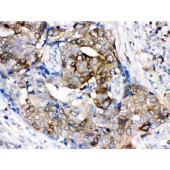 STMN1 / Stathmin / LAG Antibody (aa2-34)