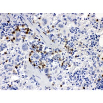Polyclonal Rabbit anti-Mouse CSF1 / MCSF Antibody (aa33-262, IHC)