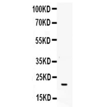 CSF3 / G-CSF Antibody (aa38-207)