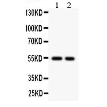 Polyclonal Rabbit anti-Human CSTA / Cystatin A Antibody (aa8-98, IHC, WB)
