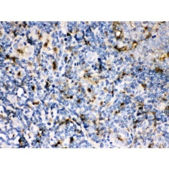 Polyclonal Rabbit anti-Human CSTA / Cystatin A Antibody (aa8-98, IHC, WB)