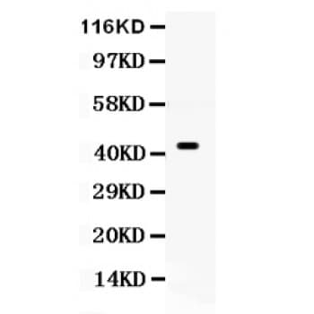 Polyclonal Rabbit anti-Human CDC37 Antibody (aa216-378, WB)