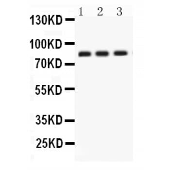 CLU / Clusterin Antibody (aa228-449)