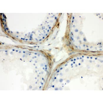CLU / Clusterin Antibody (aa228-449)