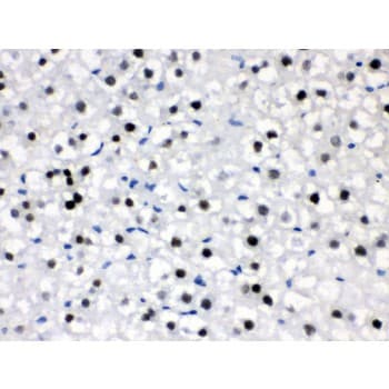Polyclonal Rabbit anti-Human CRY2 Antibody (aa171-200, IHC, WB)
