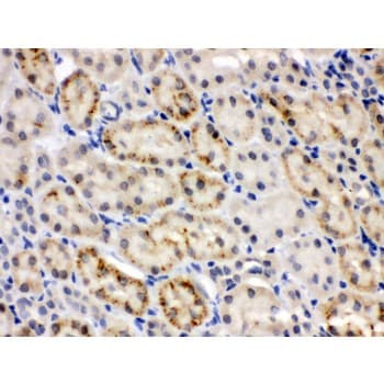 Polyclonal Rabbit anti-Human CRY2 Antibody (aa171-200, IHC, WB)